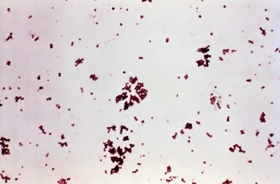 gram, micrograph, staphylococcus aureus, bacteria, toxic, shock, syndrome