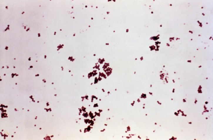 gram, mikroskop-bilde, staphylococcus aureus, bakterier, giftig, støt, syndrom