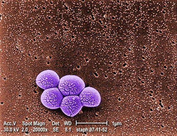 agrupación, meticilina y resistentes, el estafilococo aureus, MRSA, bacterias