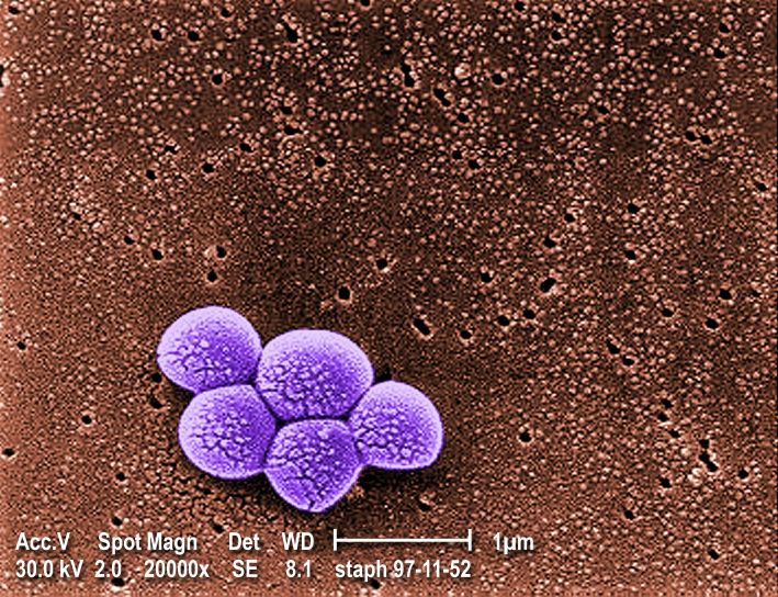 zoskupenie, meticilín rezistentné staphylococcus aureus, mrsa, baktérie