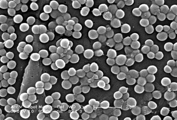 metisilliinille resistenttien, staphylococcus aureus bakteerit