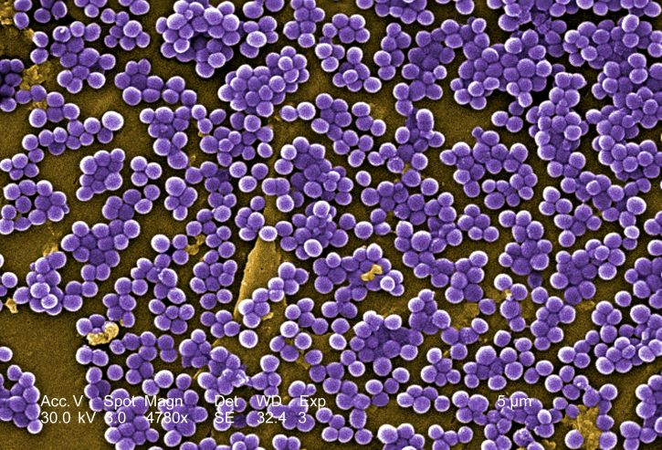 耐甲氧西林, 葡萄球菌, 金黄色葡萄球菌, 感染