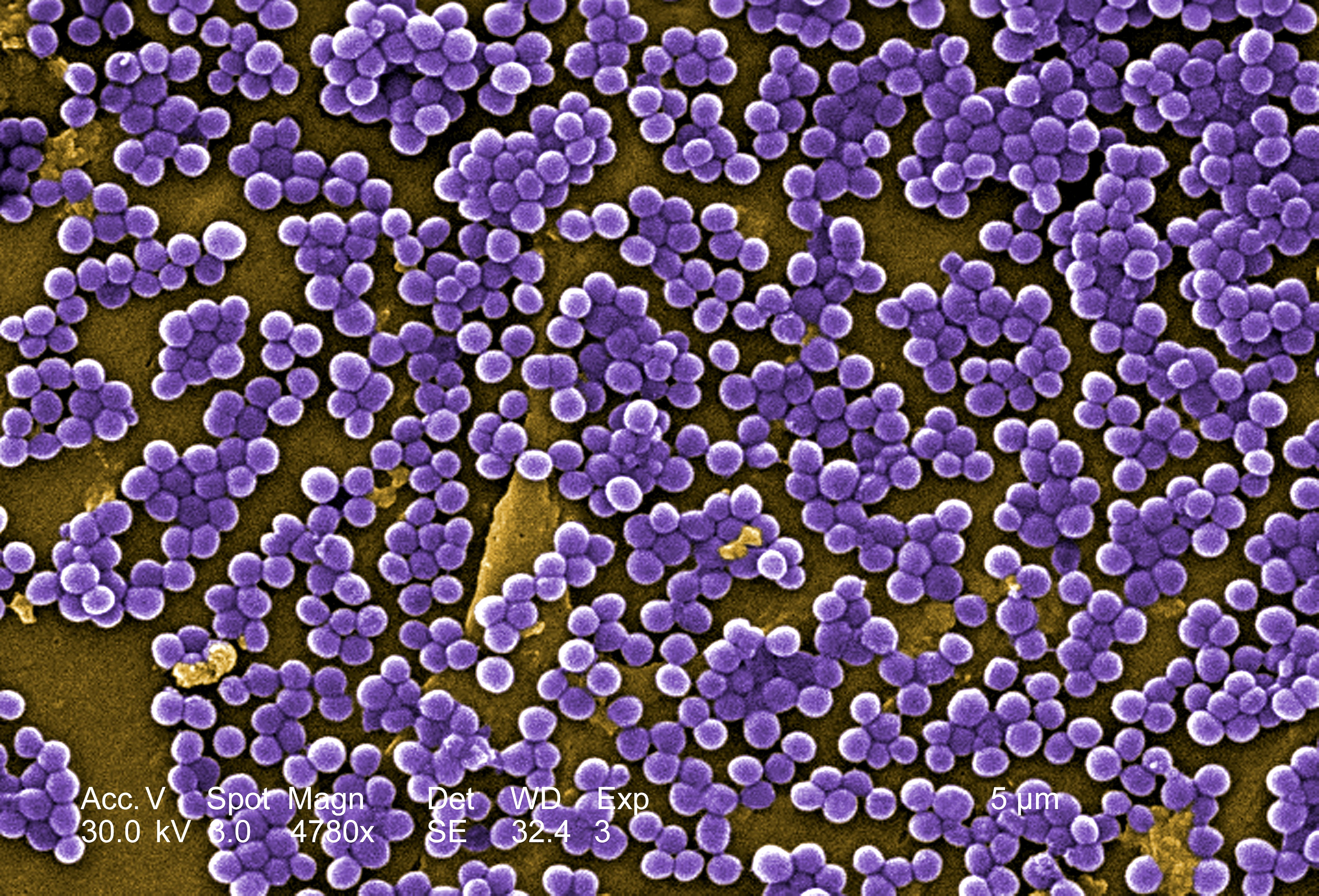 Staphylococcus Aureus Electron Microscope