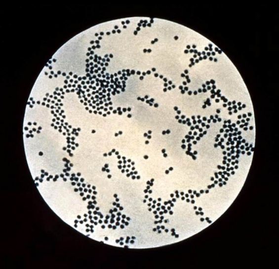 methylene, blå, mikroskop-bilde, viser, staphylococcus aureus bakterier, giftig, sjokk, syndrom
