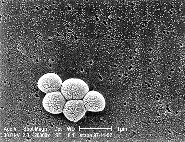Микрография, обединение, метицилин резистентни, Стафилококус ауреус, mrsa, бактерии