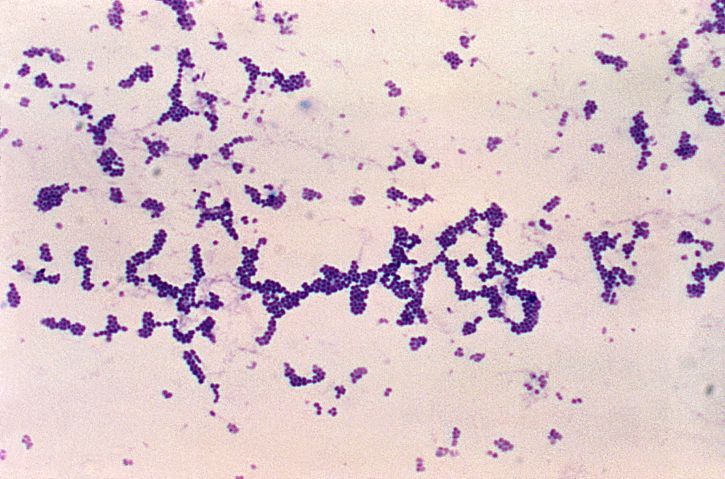microphotographie, sphérique, cocci, gram, positif, Staphylococcus aureus, les bactéries, grossie, 250x