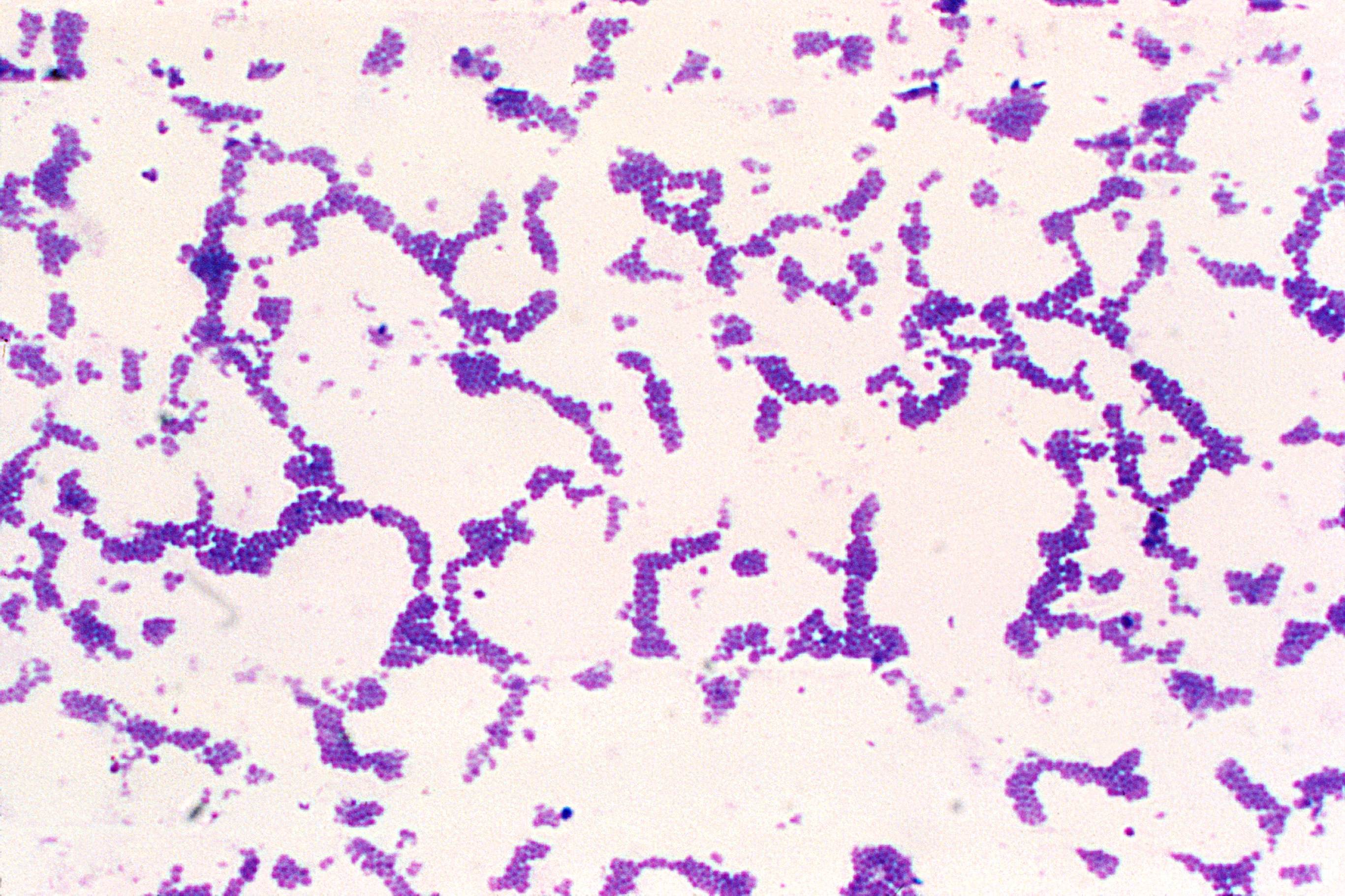 Бактерии staphylococcus aureus. Стафилококк ауреус микроскопия. Грамположительные кокки. Микрококки.. Грамотрицательные кокки микроскопия. Грамположительные кокки. Стафилококки..