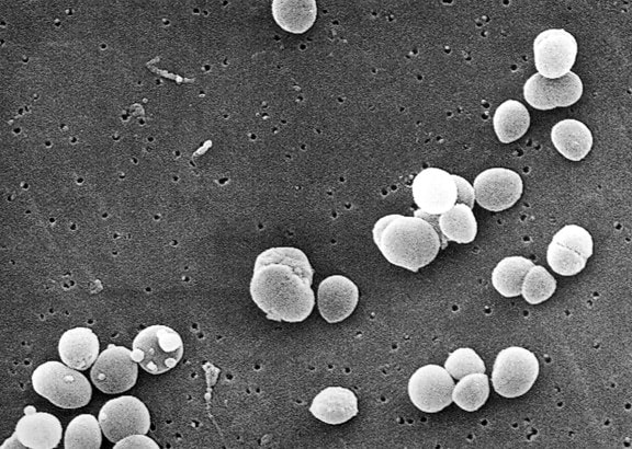 細菌黄色ブドウ球菌、黄色ブドウ球菌陽性