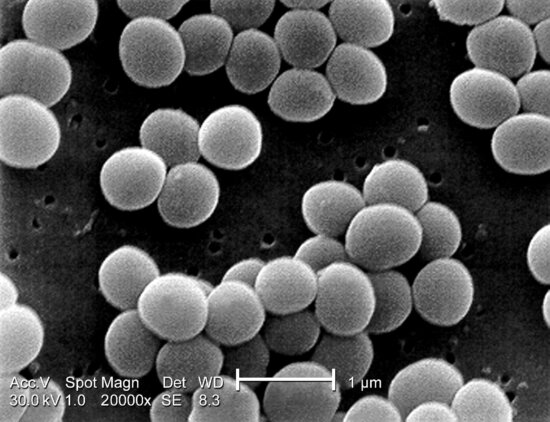 Staphylococcus Aureus Cells At Work