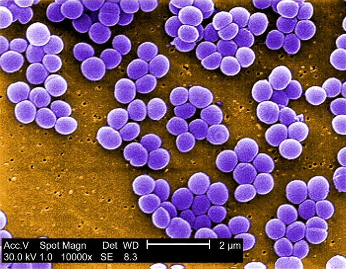Staphylococcus aureus bakterier, vancomycin, middels, motstandsdyktig, kultur, visa