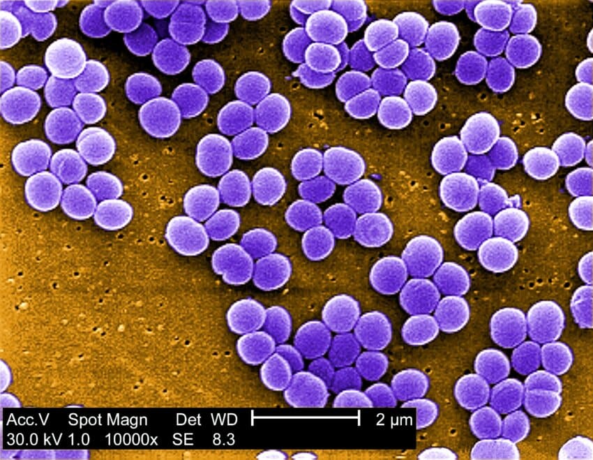 Free picture: staphylococcus aureus, bacteria, vancomycin, intermediate ...