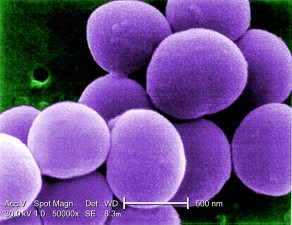 Free picture: staphylococcus aureus, bacteria, vancomycin, intermediate ...