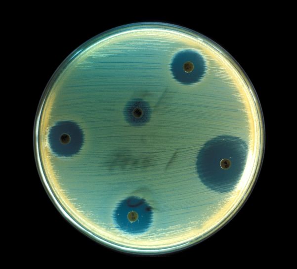 毒素、黄色ブドウ球菌、黄色ブドウ球菌、病気、ブドウ球菌性中毒