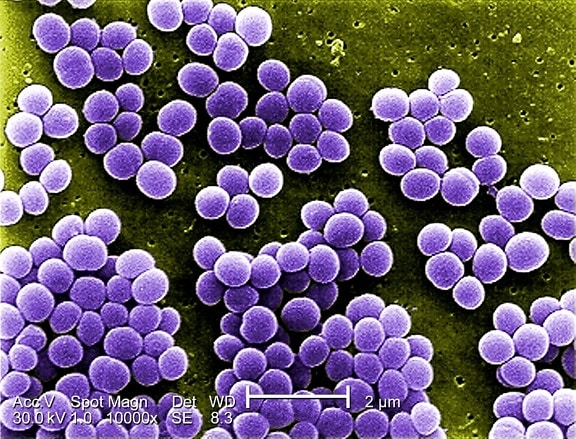 high, magnification, 10000x, strain, staphylococcus aureus, bacteria