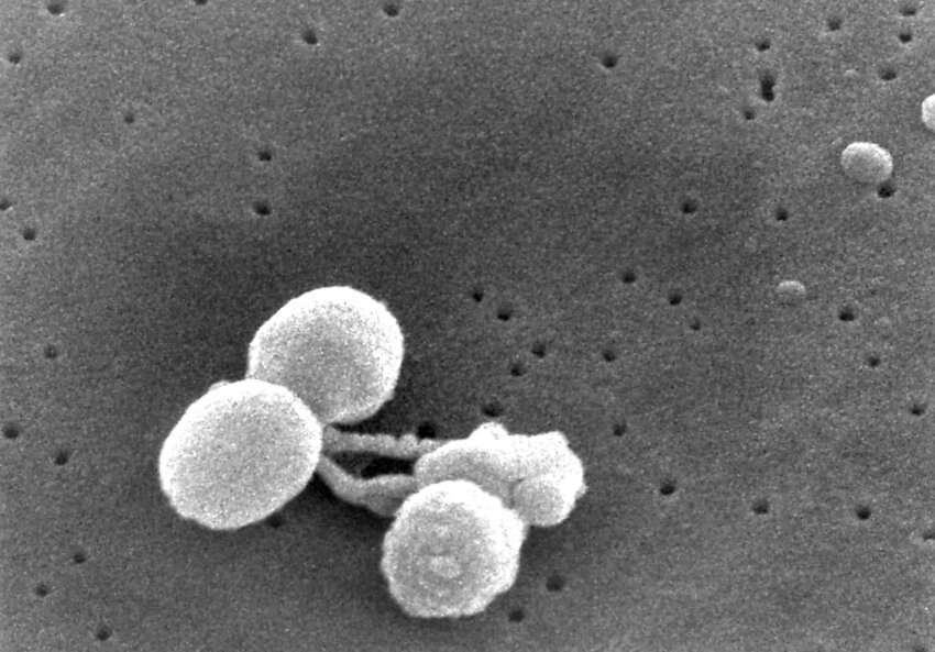 Kostenlose Bild Gramm Positiv Streptokokken Pneumoniae Bakterien