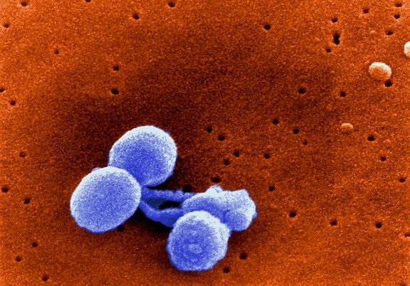 Scanning elektronmikroszkópos mikrokamera streptococcus pneumoniae, pneumococcus, streptococcusok