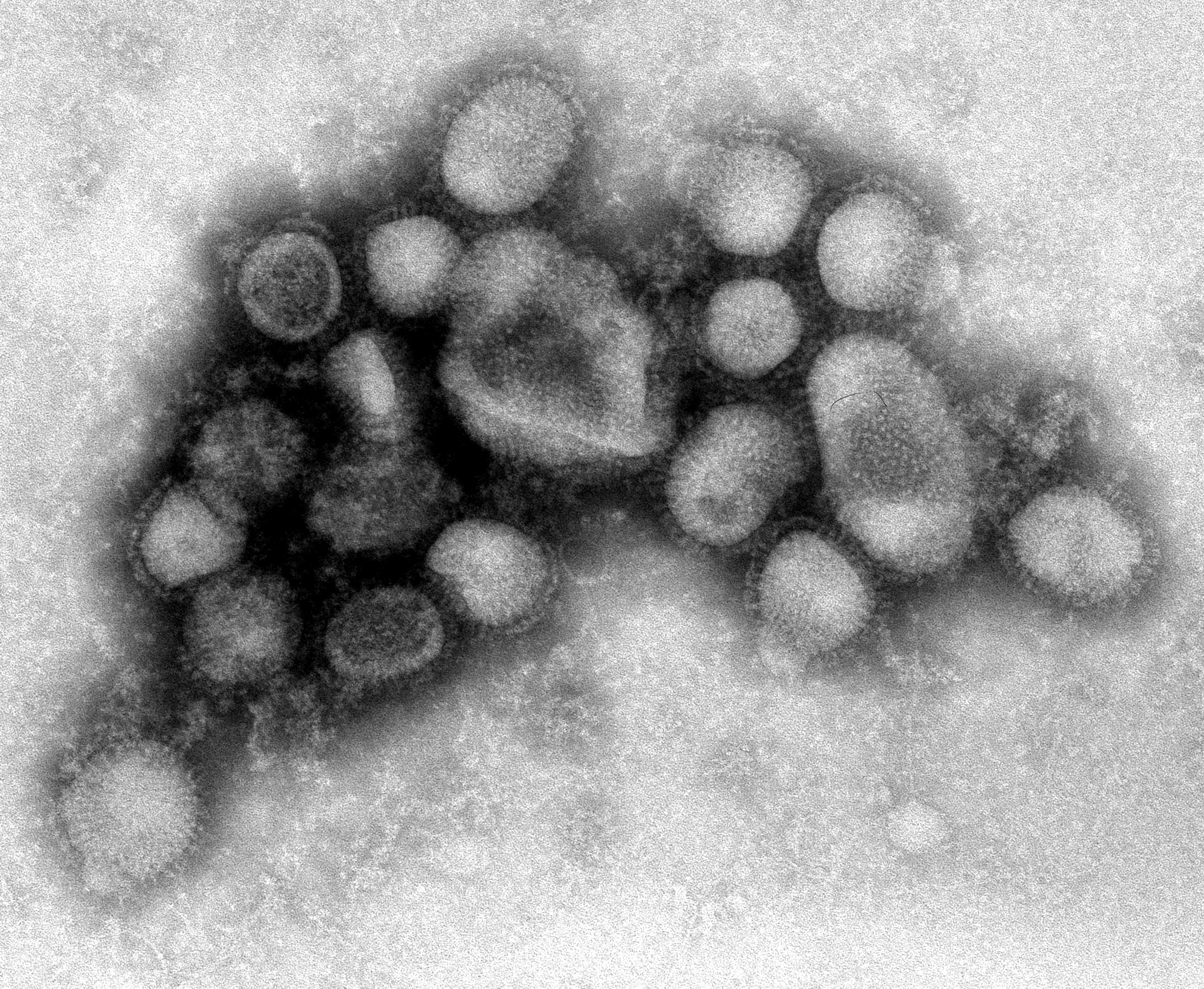 Вирус гриппа под. Вирус свиного гриппа (h1n1). Вирус гриппа под микроскопом h1n1. Вирус свиного гриппа под микроскопом. Вирус испанки под микроскопом.