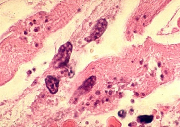 หัวใจ myocytes มากมาย tachyzoites, toxoplasma gondii ปรสิต