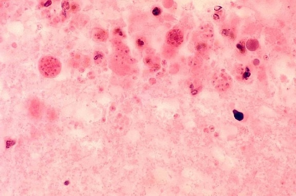 มาก ภายในเซลล์ สาร tachyzoites, toxoplasma gondii มองเห็น ปรสิต
