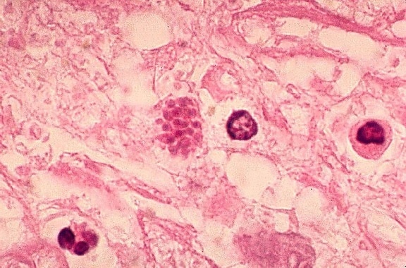 pseudocyst, 포함, 수많은, tachyzoites, toxoplasma gondii