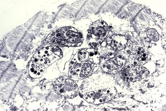 taquizoitos, toxoplasma gondii, visible, pseudoquistes, estriado, infarto, miocitos