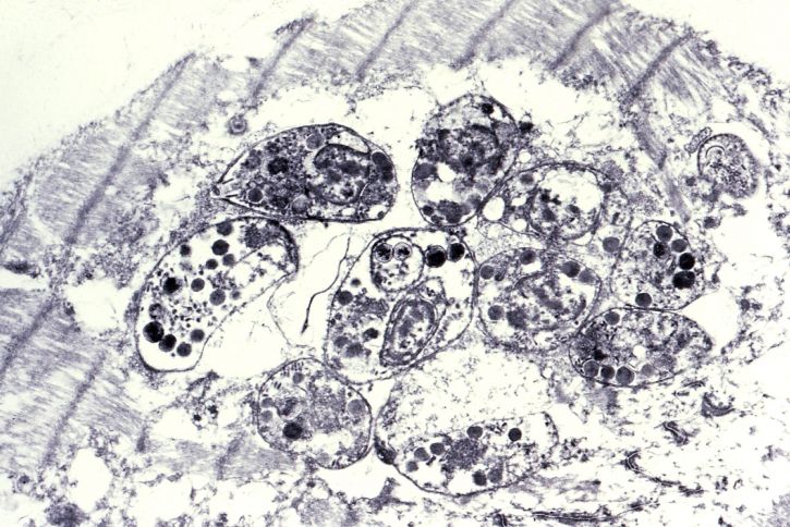 tachyzoites, toxoplasma gondii, nhìn thấy được, pseudocyst, khối, cơ tim, myocyte
