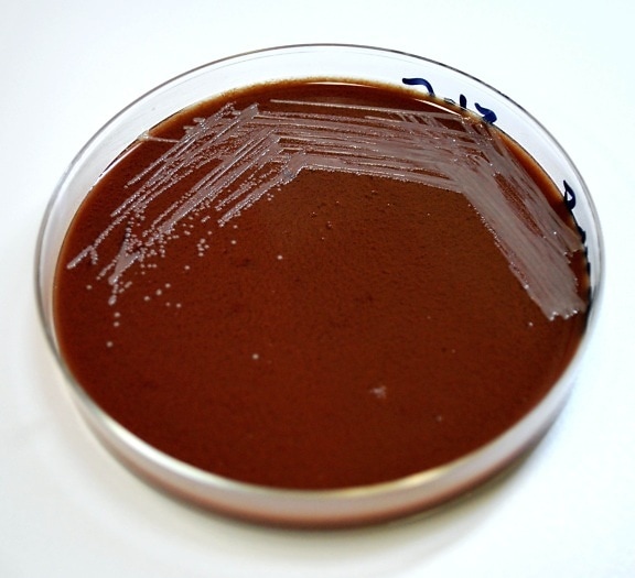 chocolate, agar, inoculated, gram, negative, francisella, tularensis