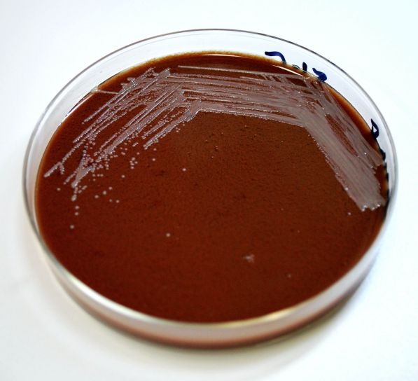 chocolate, agar, se inoculó, gramo, negativo, Francisella tularensis