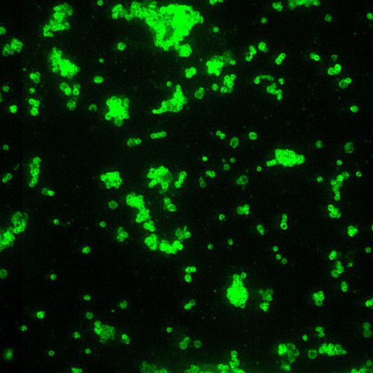 Franciscella tularensis, přímý, fluorescenční, protilátek, skvrna, 1000 x, zvětšení