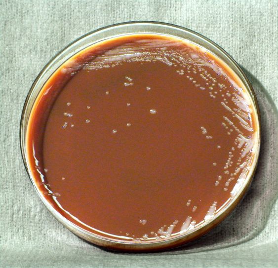 Francisella tularensis, bakterie, Zamknij