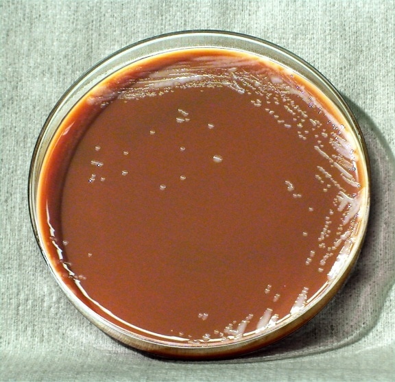Franciscella tularensis, bakterie, zavřete