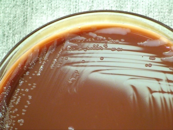 Francisella, tularensis, batteri, cresciuto, cioccolato, agar