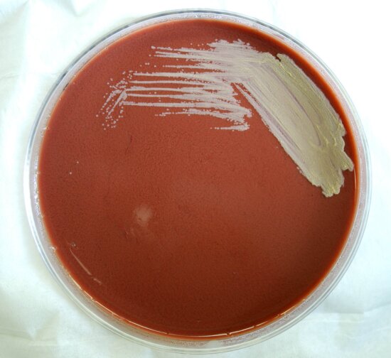 gram, negative, francisella, tularensis, bacteria