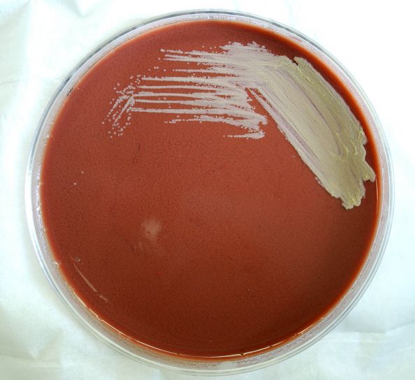 กรัม ลบ francisella, tularensis แบคทีเรีย