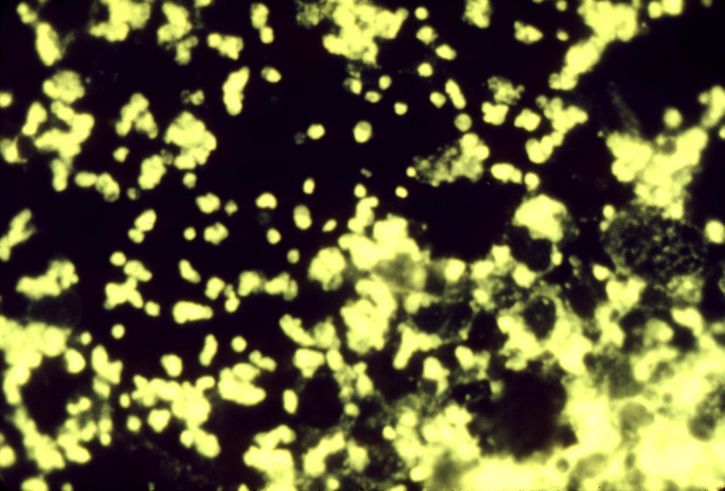 Fotomicrografia francisella tularensis, bactérias, fluorescentes, anticorpo, mancha