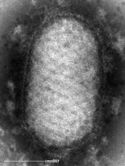 Ultrastrukturální, detaily, virus, člen, rod, parapoxvirus