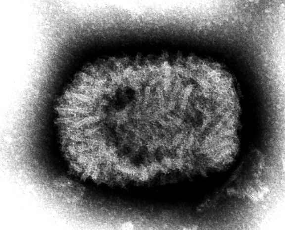 天然痘、ダブル、座礁、dna、ウイルス、属、orthopoxvirus