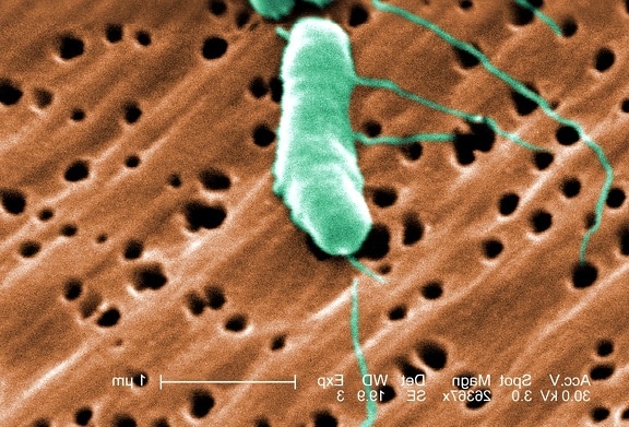 obarvené, skenování, elektronové mikrofotografie, totiž vibrio vulnificus, bakterie, mag, 26367 x