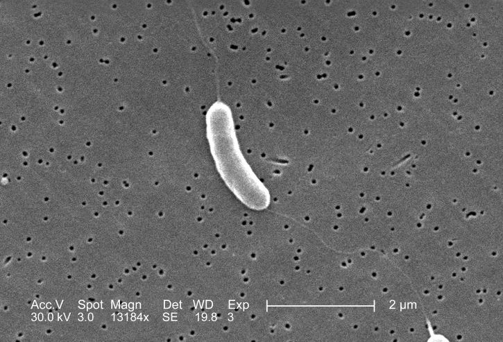flagelado, vibrio vulnificus, una bacteria