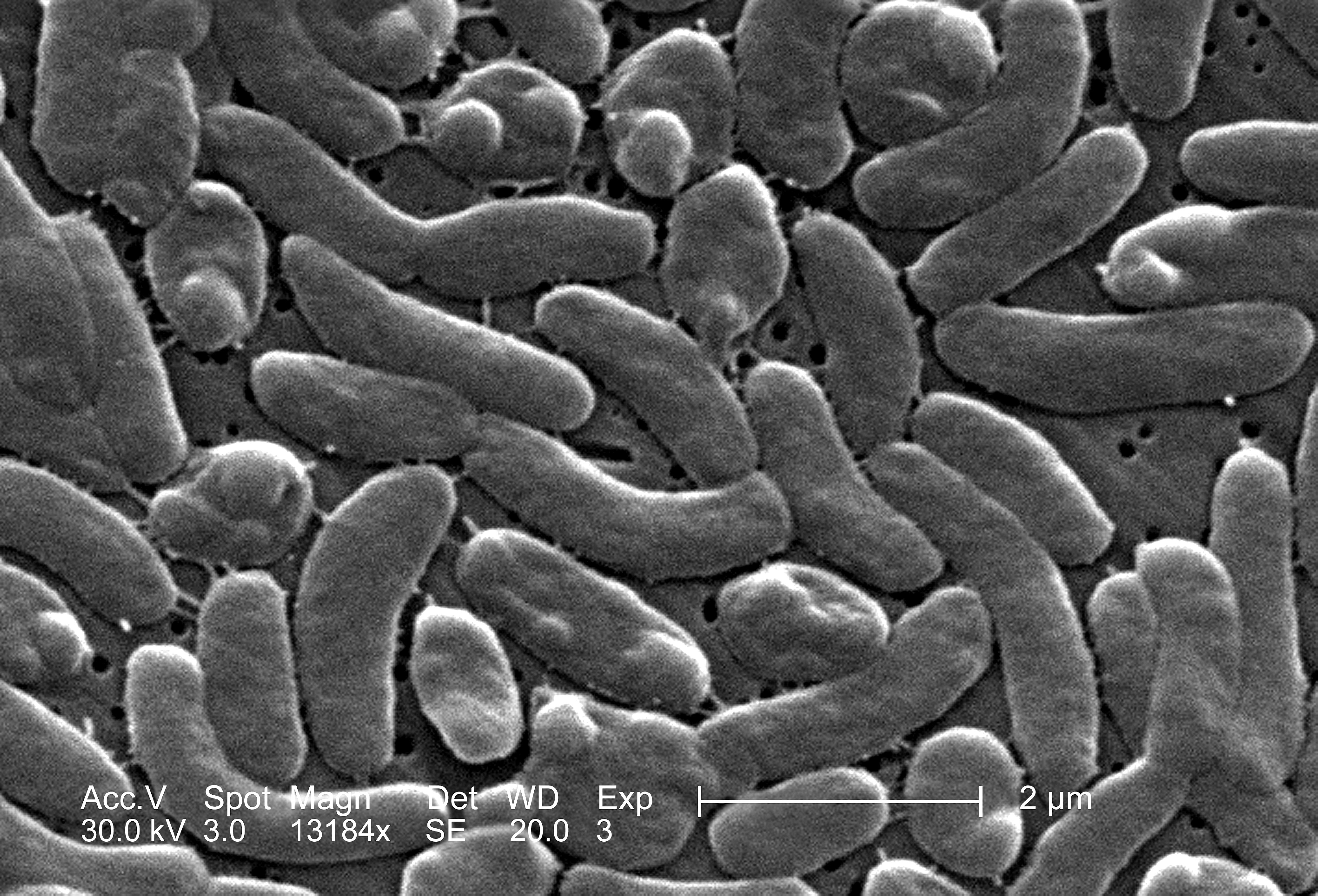 vibrio baktériumok májrák ppt