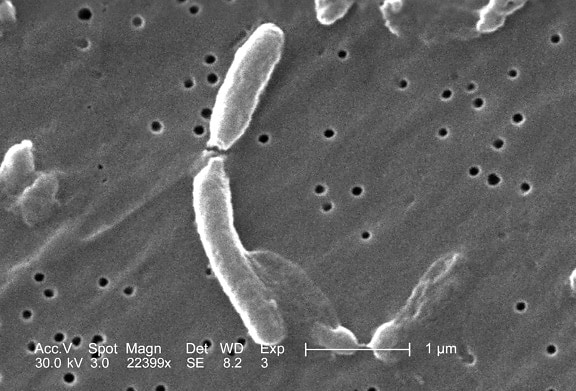 elektronmikroszkópos, két, vibrio cholerae baktérium