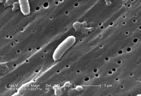 Vibrio cholerae, bacterii serogrup, amplificată, 22371 x