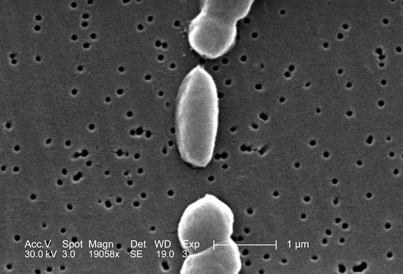 Vibrio parahaemolyticus, bakterier, mag, 19058 x