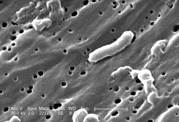 Vibrio cholerae, bakteri, elektron mikrograf