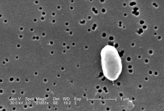 vibrio parahaemolyticus, Bakterien, elektronenmikroskopische Aufnahme