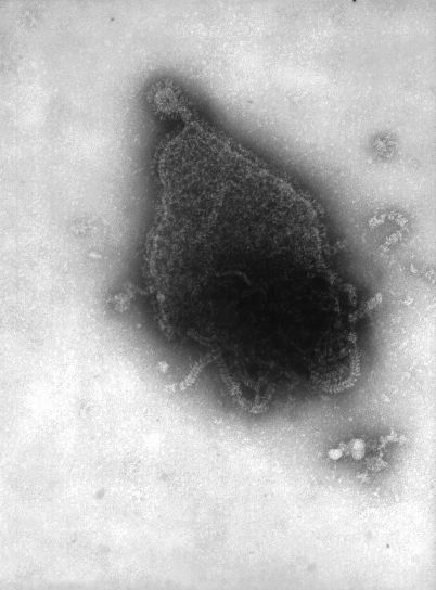 virus, hpiv, paramyxoviridae, perhe, jäsen, jäsen, suku, rubulavirus