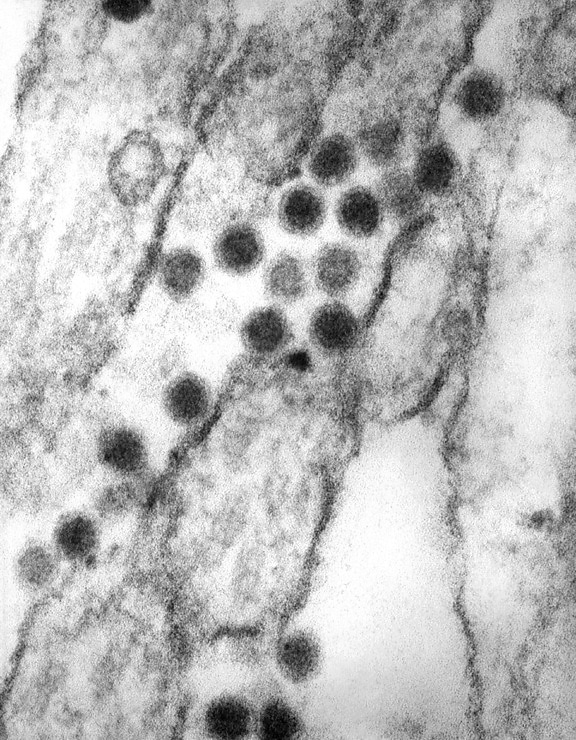 virus, člen, rod, flavivirus, Rodina, flaviviridae