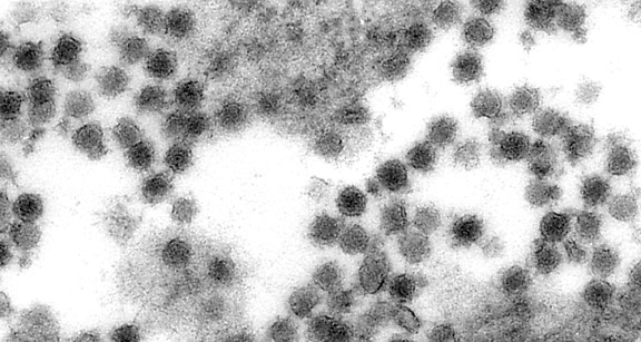 electron micrograph, west, Nile, virus